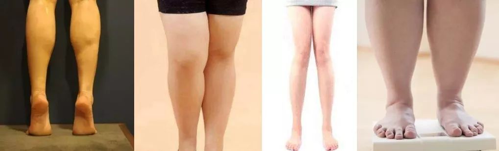 跑完步脚底痛？滚一滚它就管用，还能瘦小腿