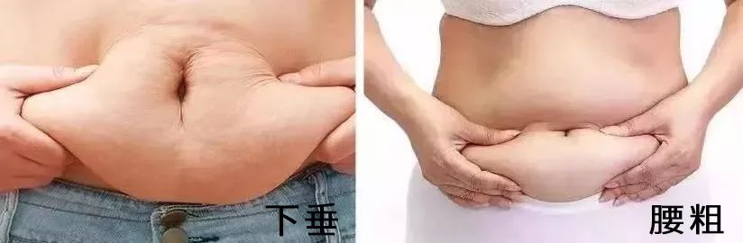 告别大肚子水桶腰,告别大肚腩练出筷子腿