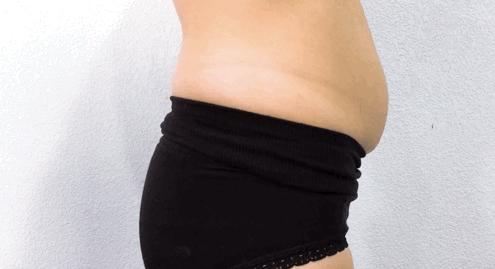 告别大肚子水桶腰,告别大肚腩练出筷子腿