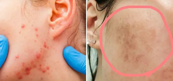 告别大肚子水桶腰,告别大肚腩练出筷子腿