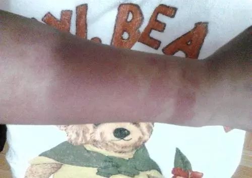 风油精创可贴真的防晕车吗,风油精加创可贴是真的吗