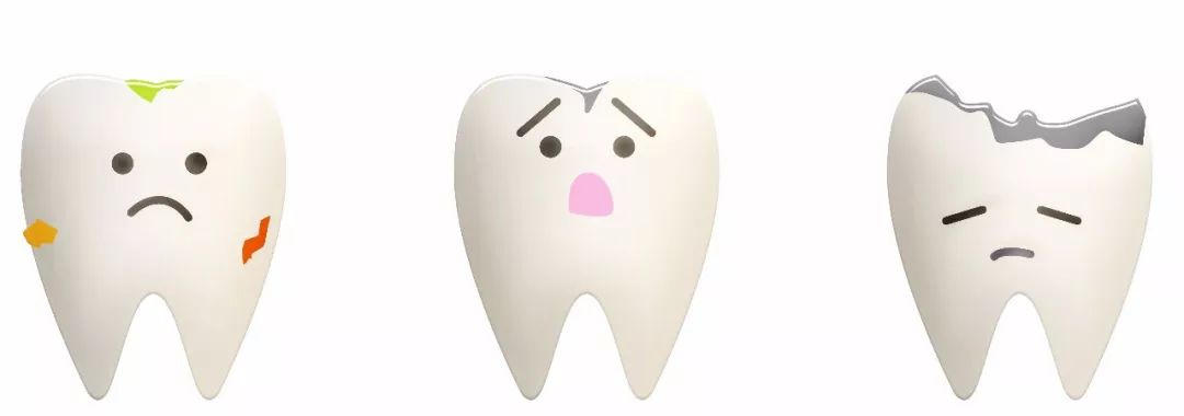 牙缝太大会有影响吗,牙缝大会影响颜值么