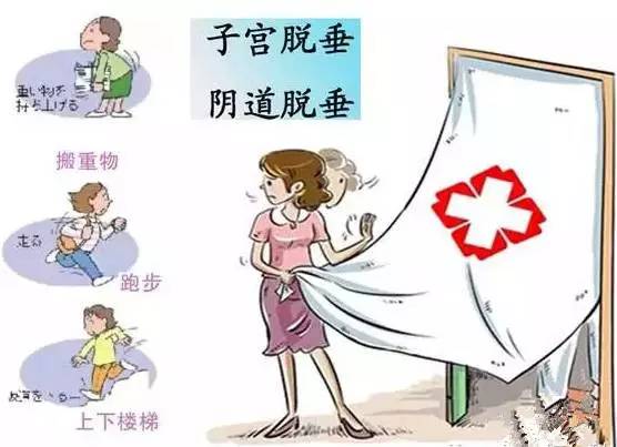 大笑就会尿失禁,盆底松弛尿失禁怎么治疗