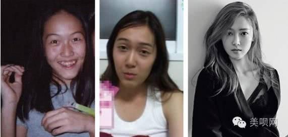 韩国整容最漂亮的女明星,韩国整容女明星最多的