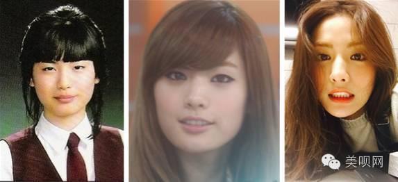韩国整容最漂亮的女明星,韩国整容女明星最多的