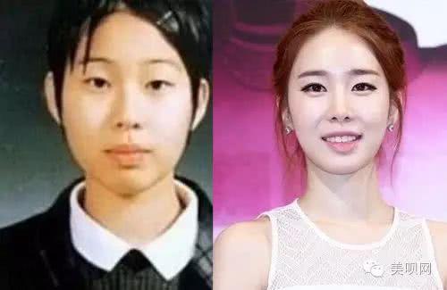 韩国整容最漂亮的女明星,韩国整容女明星最多的