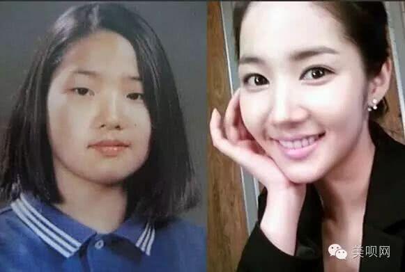 韩国整容最漂亮的女明星,韩国整容女明星最多的