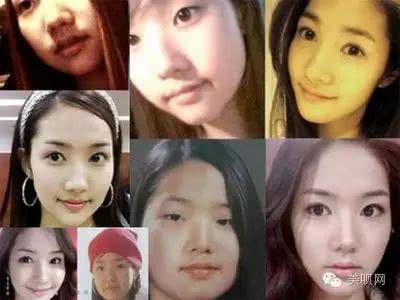 韩国整容最漂亮的女明星,韩国整容女明星最多的