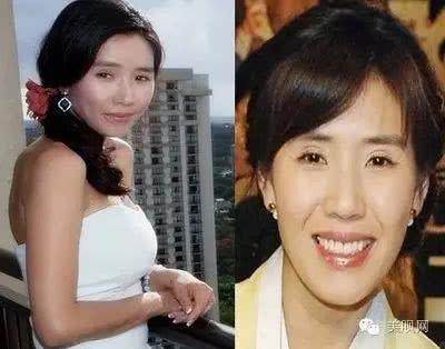 韩国整容最漂亮的女明星,韩国整容女明星最多的
