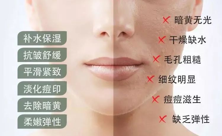 芦荟胶补水保湿提亮肤色晒后修复,万能芦荟胶补水美白修复敏感肌