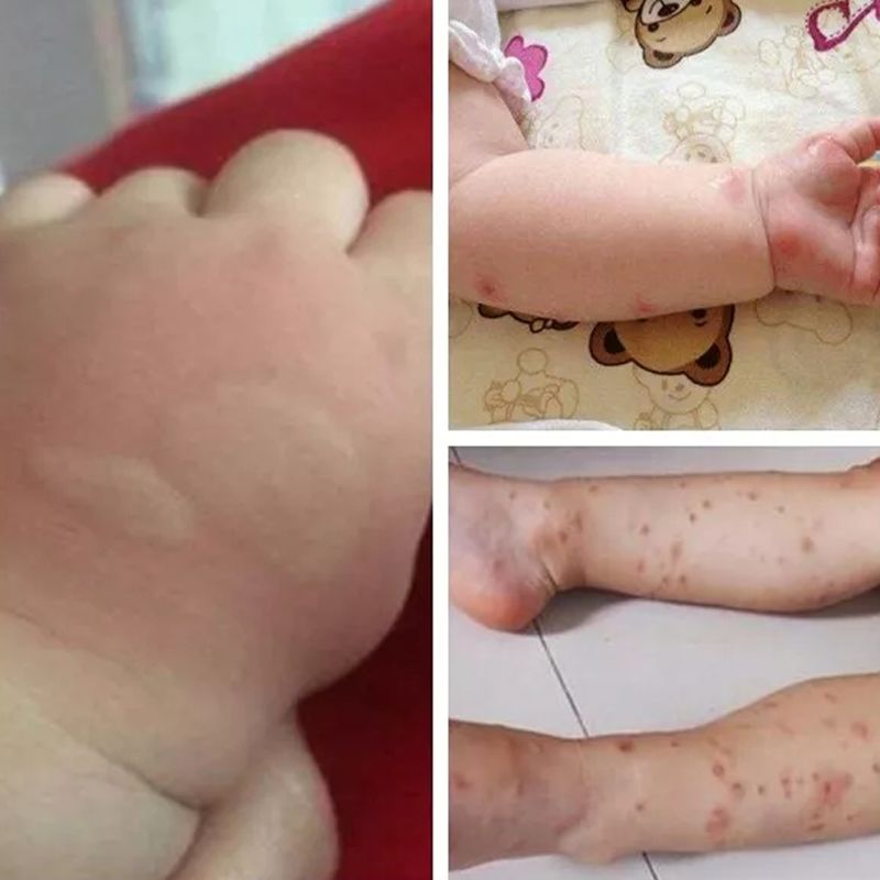 植物萃取喷雾防蚊驱蚊,驱蚊喷雾植物萃取温和不刺激