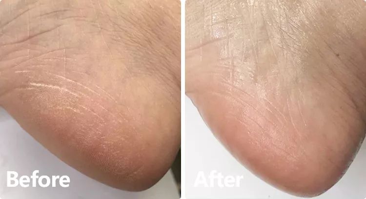 最可以让脚变臭的袜子,有哪些好用不会脚臭的袜子