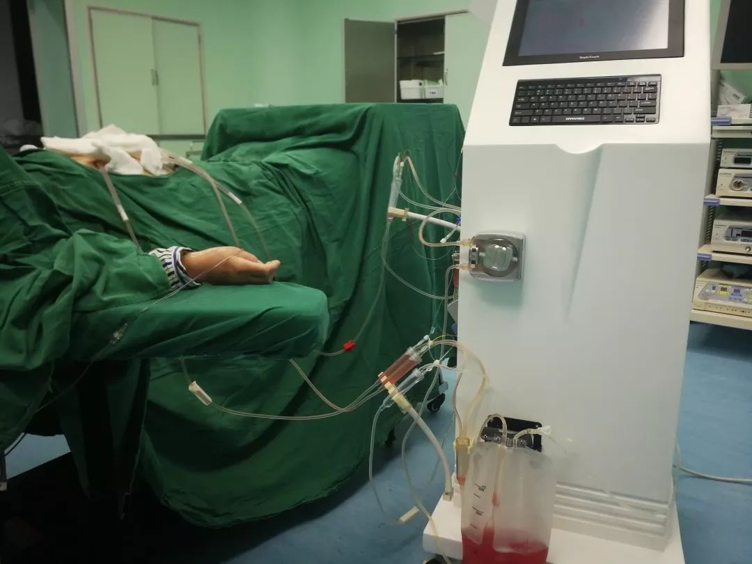 热灌注化疗器械,热化疗灌注机配置单