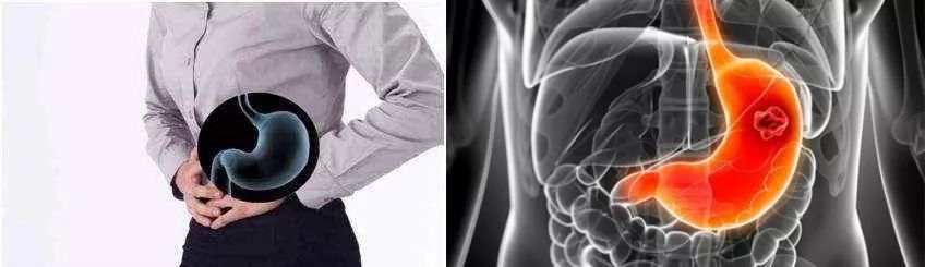 小编推荐丨缓解咳嗽、口臭,试试这个“千金方”!澳洲纯植物提取