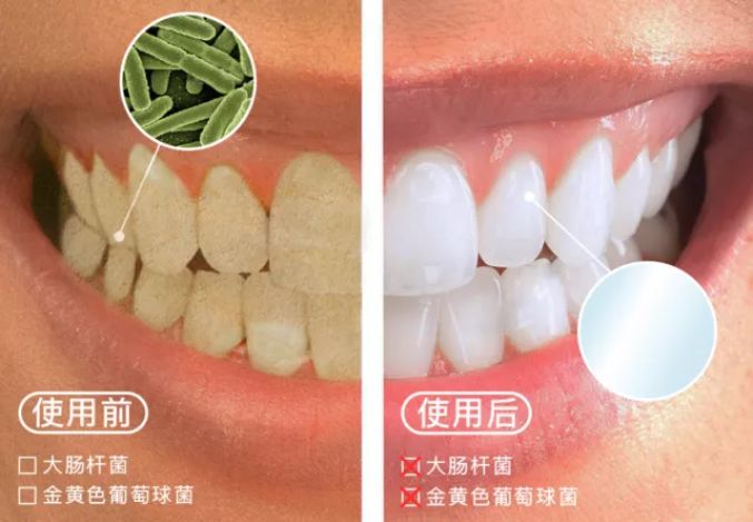 小编推荐丨缓解咳嗽、口臭,试试这个“千金方”!澳洲纯植物提取