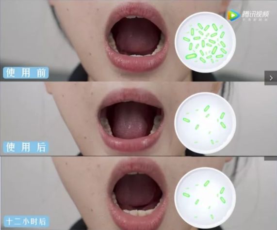 小编推荐丨缓解咳嗽、口臭,试试这个“千金方”!澳洲纯植物提取