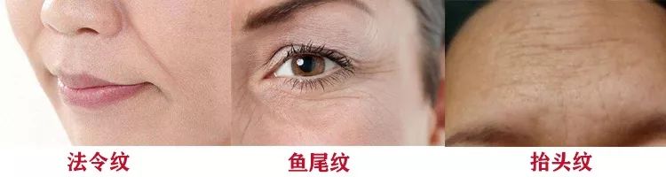 睡前一分钟做好这件事就能抗皱纹,最近比较火的淡化皱纹方法