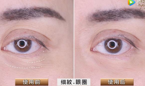 睡前一分钟做好这件事就能抗皱纹,最近比较火的淡化皱纹方法