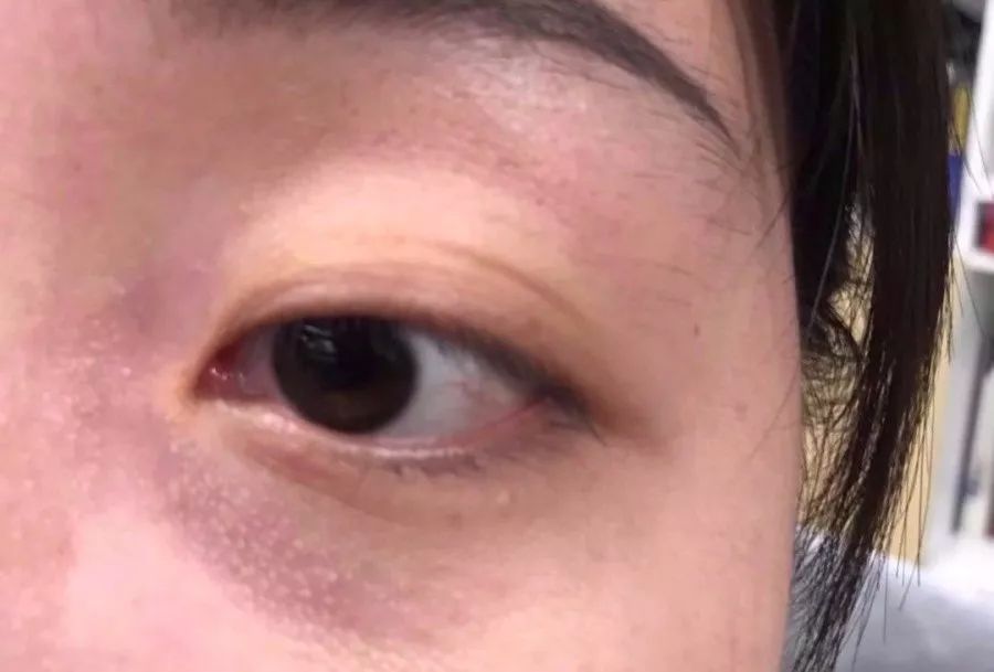 睡前一分钟做好这件事就能抗皱纹,最近比较火的淡化皱纹方法