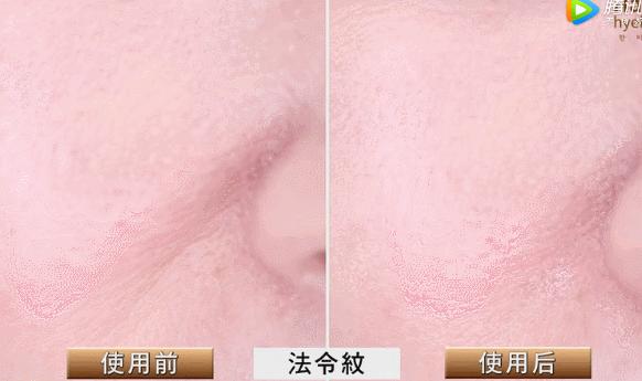 睡前一分钟做好这件事就能抗皱纹,最近比较火的淡化皱纹方法