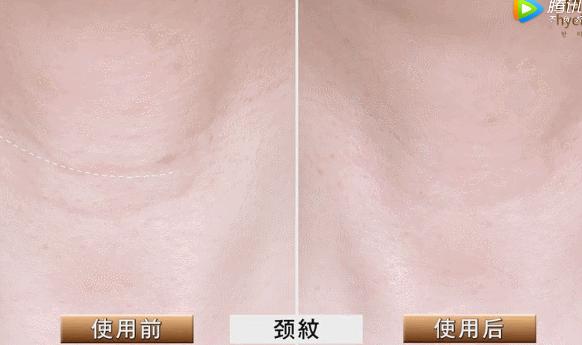 睡前一分钟做好这件事就能抗皱纹,最近比较火的淡化皱纹方法