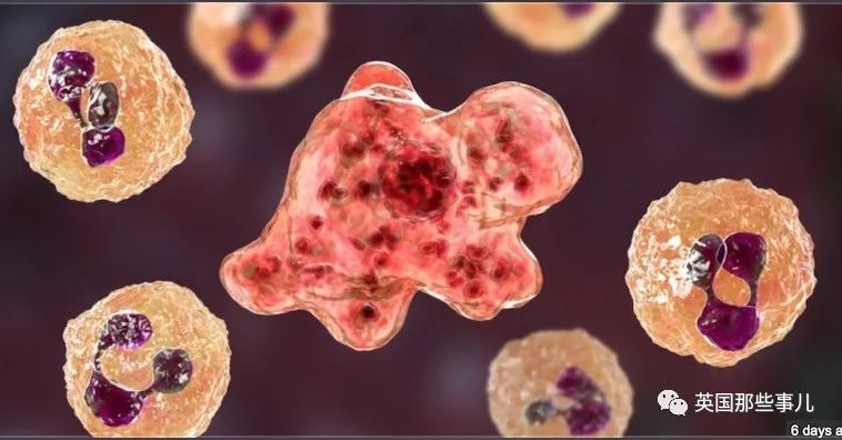 大爷感染食脑虫后一命呜呼，居然是因为游泳时呛了一口水