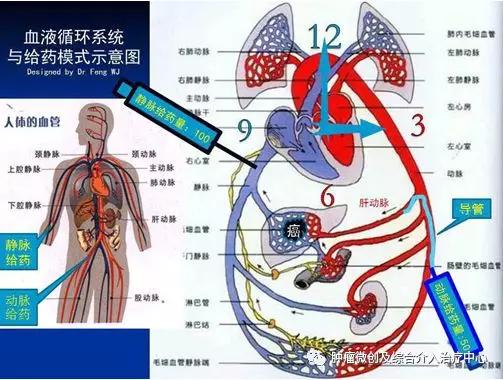 大咯血的抢救药物,支扩栓塞止血后大咯血还会复发吗
