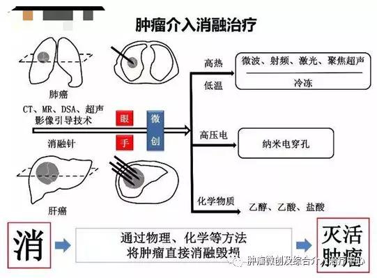 大咯血的抢救药物,支扩栓塞止血后大咯血还会复发吗