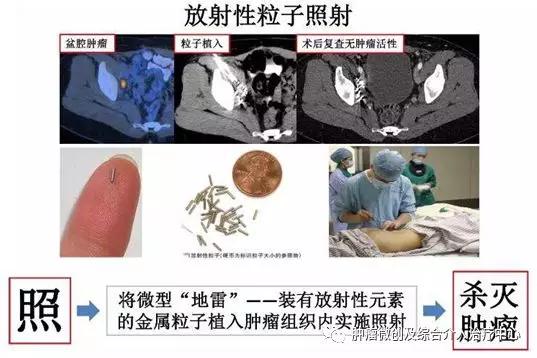 大咯血的抢救药物,支扩栓塞止血后大咯血还会复发吗