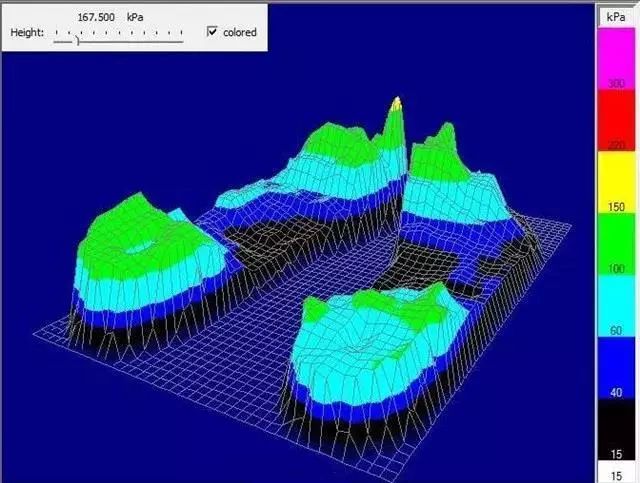 一双鞋竟装上28片“刀锋”弹簧？！穿上暴走跳跃，感觉能起飞了