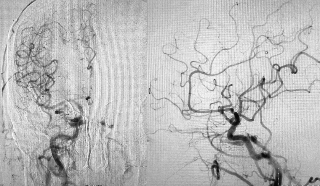 柳暗花明第二集,柳暗花明52集完整版下载