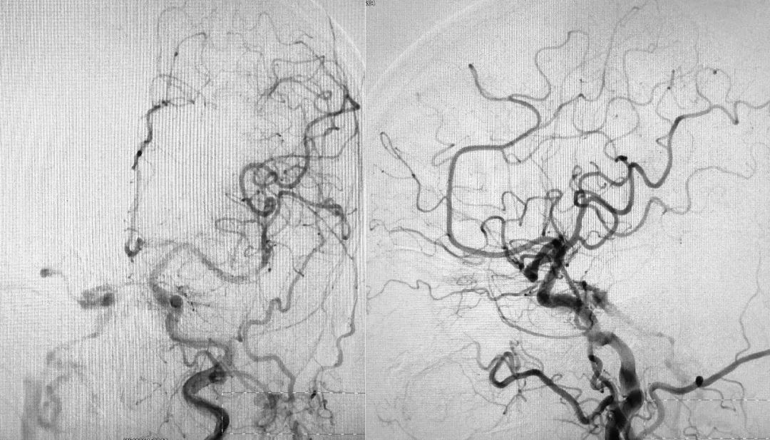 柳暗花明第二集,柳暗花明52集完整版下载