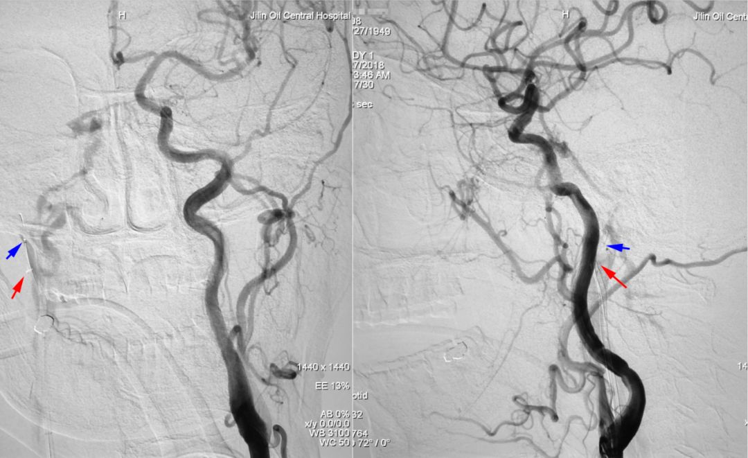 柳暗花明第二集,柳暗花明52集完整版下载