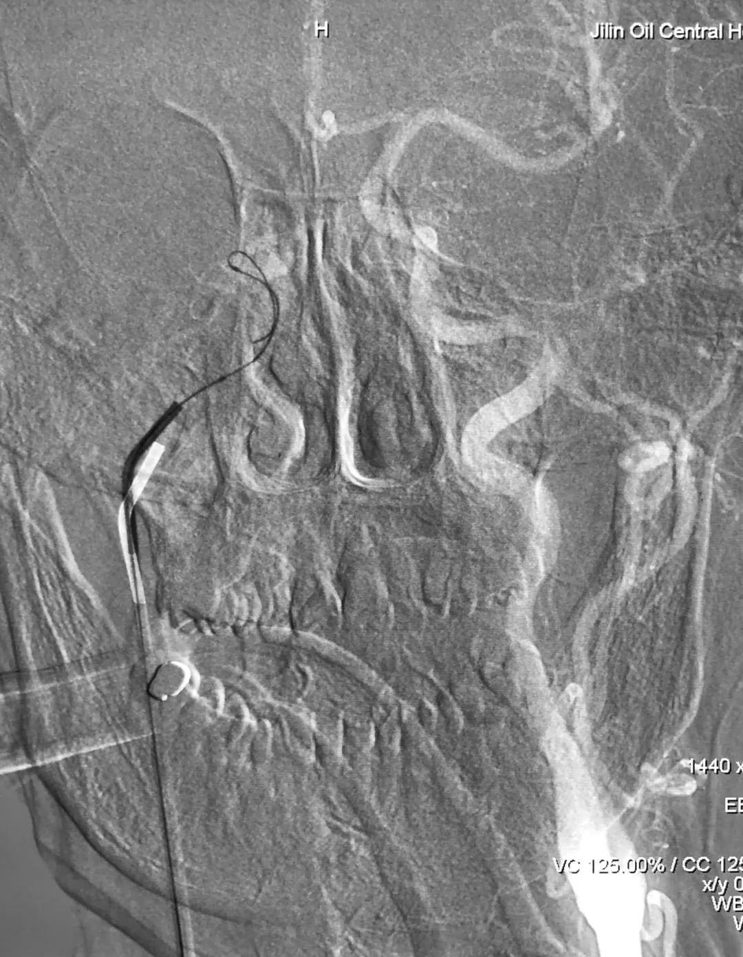 柳暗花明第二集,柳暗花明52集完整版下载