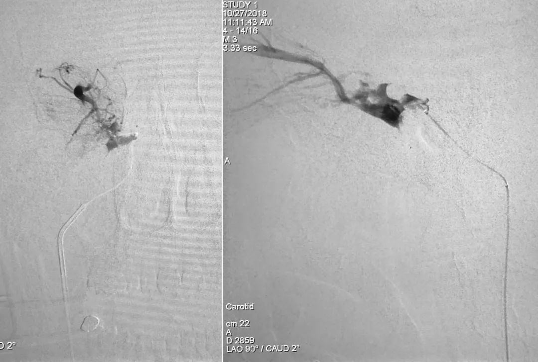 柳暗花明第二集,柳暗花明52集完整版下载