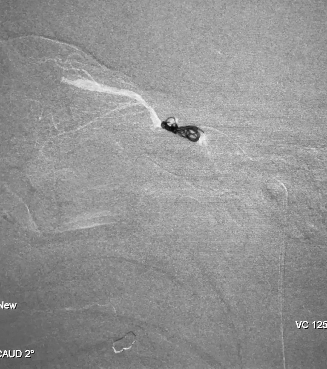 柳暗花明第二集,柳暗花明52集完整版下载