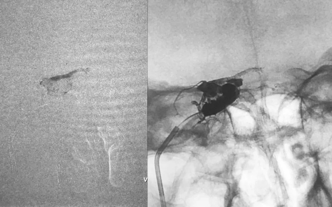 柳暗花明第二集,柳暗花明52集完整版下载