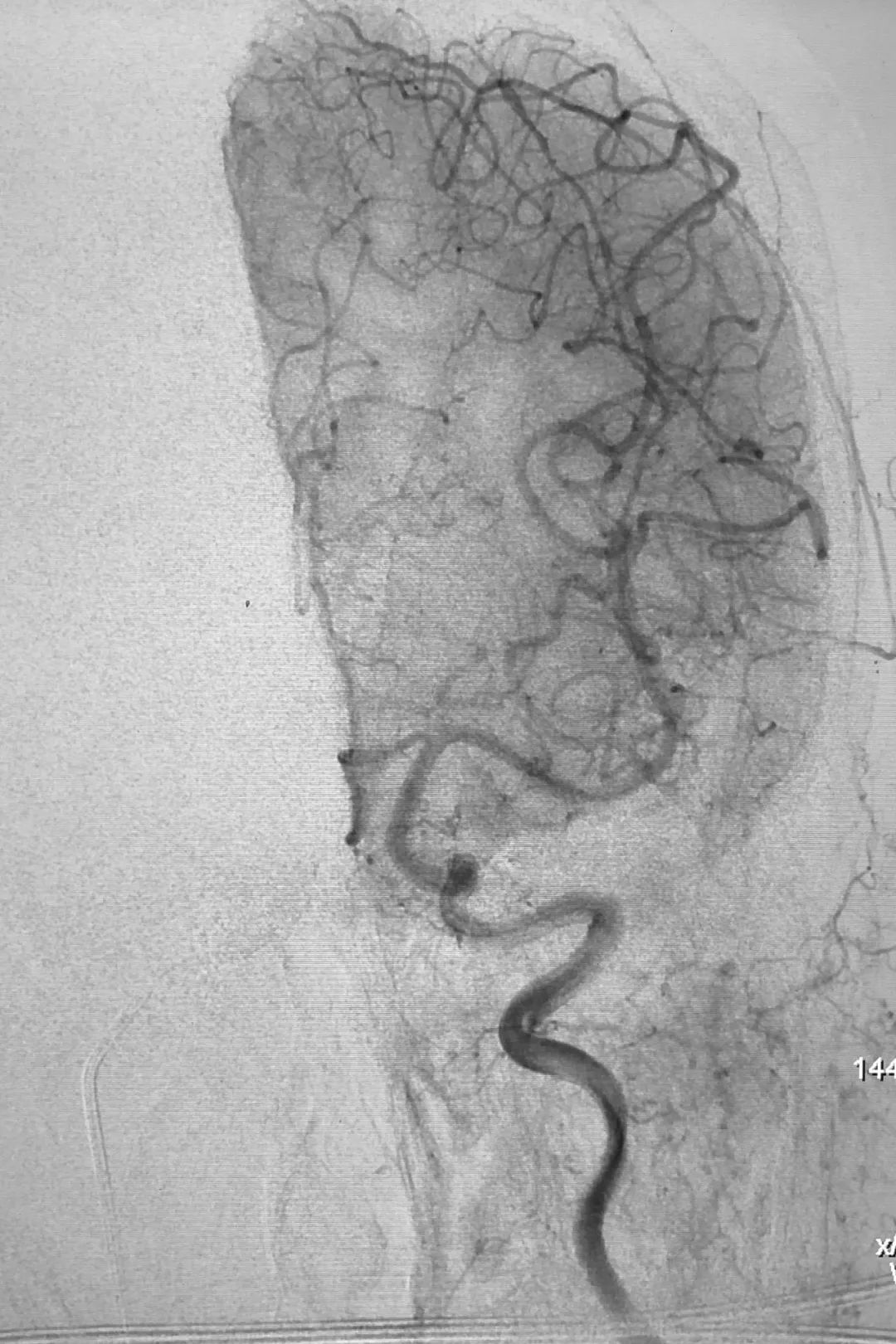 柳暗花明第二集,柳暗花明52集完整版下载