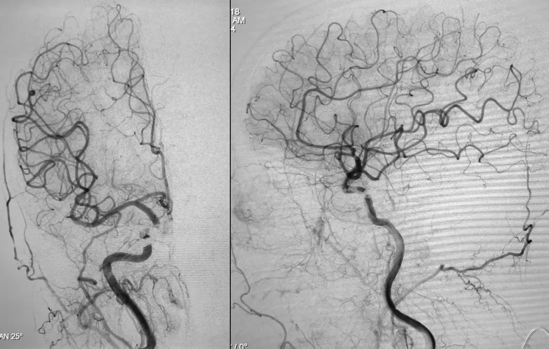 柳暗花明第二集,柳暗花明52集完整版下载