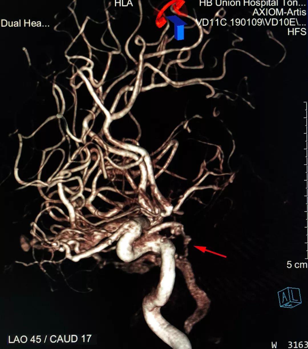 柳暗花明第二集,柳暗花明52集完整版下载