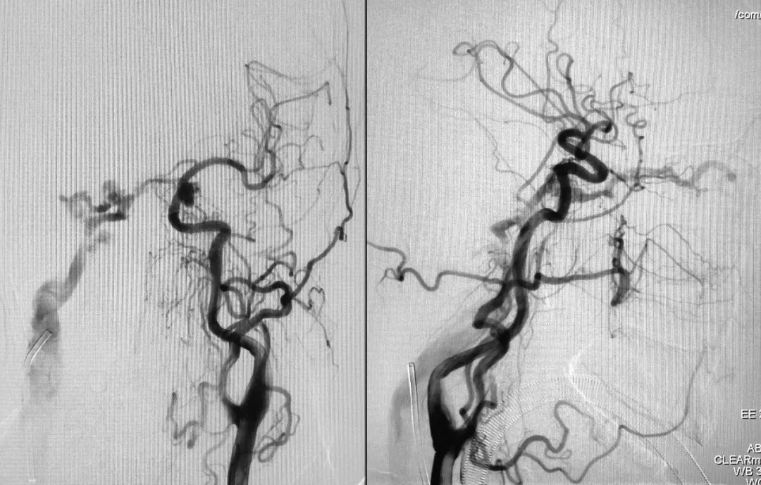 柳暗花明第二集,柳暗花明52集完整版下载