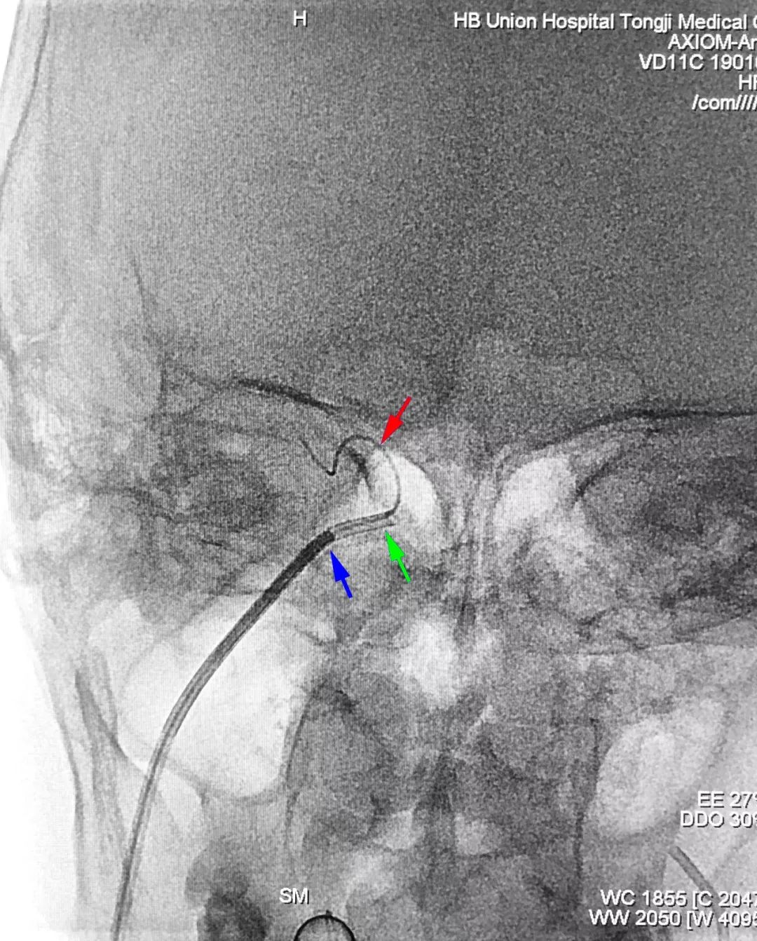 柳暗花明第二集,柳暗花明52集完整版下载