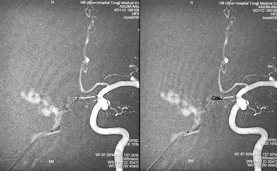 柳暗花明第二集,柳暗花明52集完整版下载