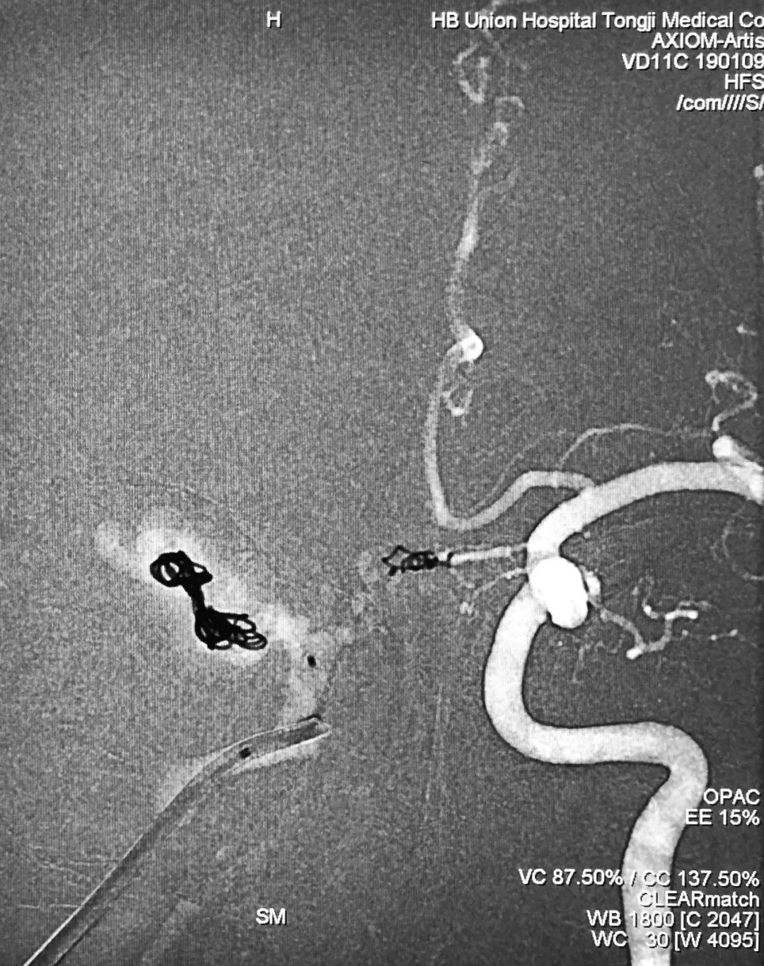 柳暗花明第二集,柳暗花明52集完整版下载