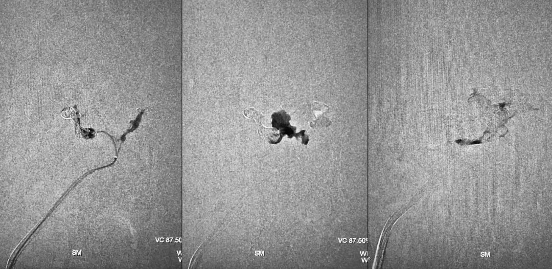 柳暗花明第二集,柳暗花明52集完整版下载