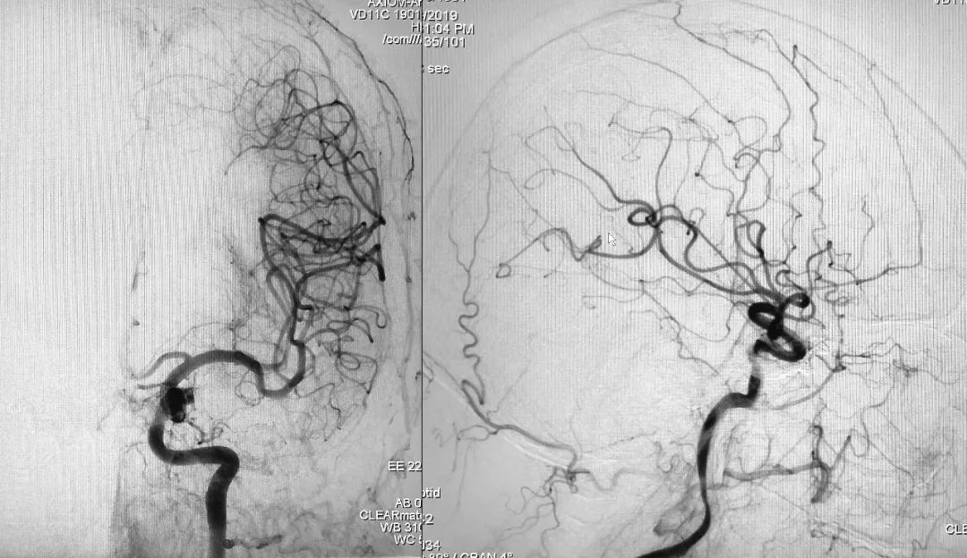 柳暗花明第二集,柳暗花明52集完整版下载