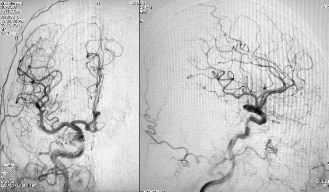 柳暗花明第二集,柳暗花明52集完整版下载
