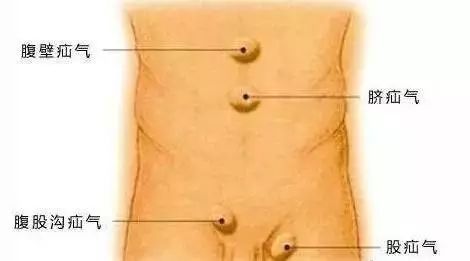 疝气复发的原因是什么,老年人疝气做过手术复发怎么办