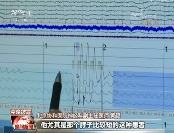 男子打鼾一夜断气576次,打鼾导致呼吸停止致死