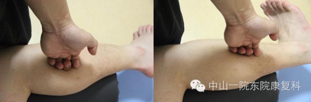 康复治疗技术人体解剖学,12条筋膜链解析及治疗手法